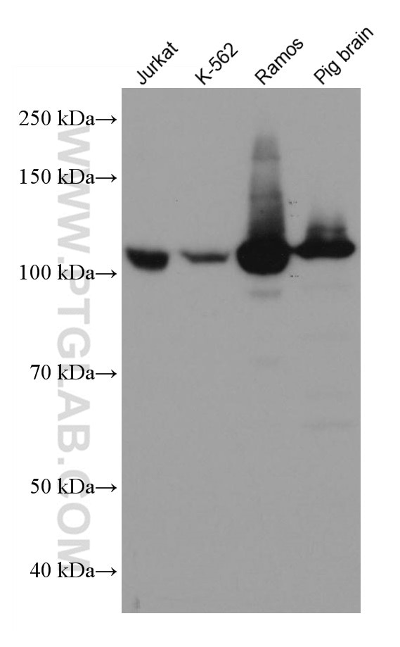 Western Blot (WB) analysis of various lysates using PTK2B Monoclonal antibody (67141-1-Ig)