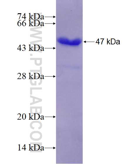 PTK2B fusion protein Ag11487 SDS-PAGE