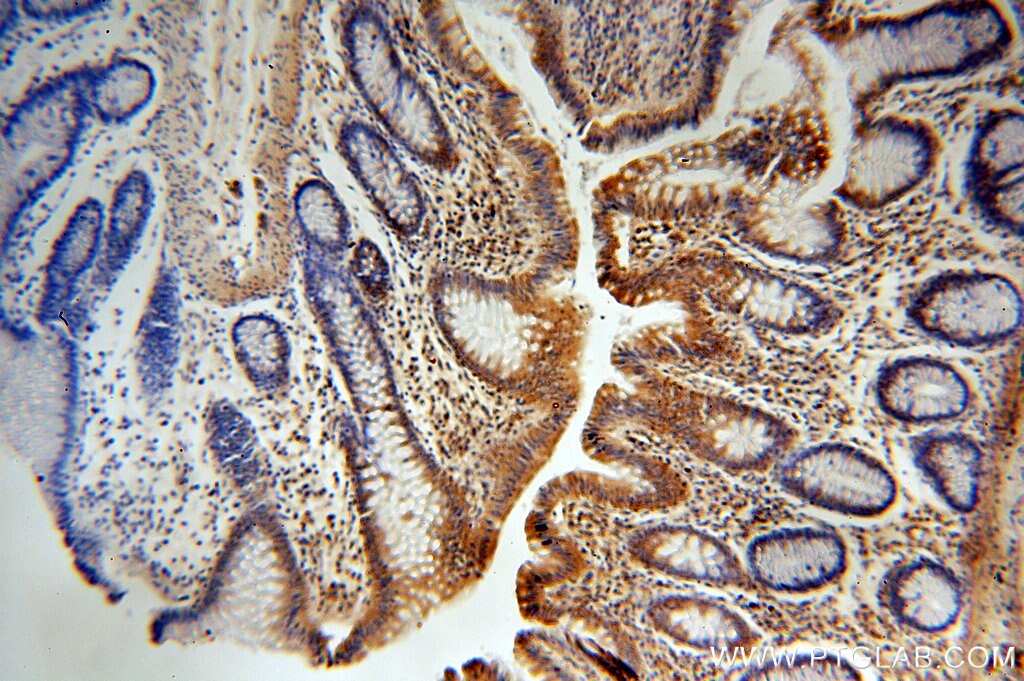 Immunohistochemistry (IHC) staining of human colon tissue using BRK Polyclonal antibody (18697-1-AP)