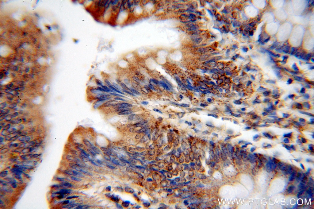 Immunohistochemistry (IHC) staining of human colon tissue using PTK6/BRK Polyclonal antibody (18697-1-AP)