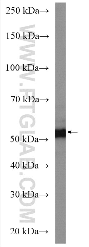 Western Blot (WB) analysis of rat spleen tissue using BRK Polyclonal antibody (18697-1-AP)