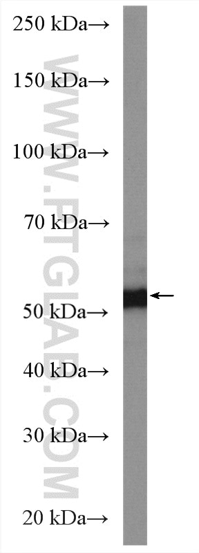 Western Blot (WB) analysis of rat spleen tissue using PTK6/BRK Polyclonal antibody (18697-1-AP)