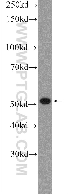 Western Blot (WB) analysis of HeLa cells using PTK6/BRK Polyclonal antibody (18697-1-AP)