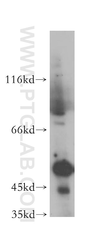PTK6/BRK