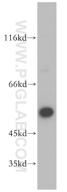 Western Blot (WB) analysis of MCF-7 cells using PTK6/BRK Polyclonal antibody (18697-1-AP)