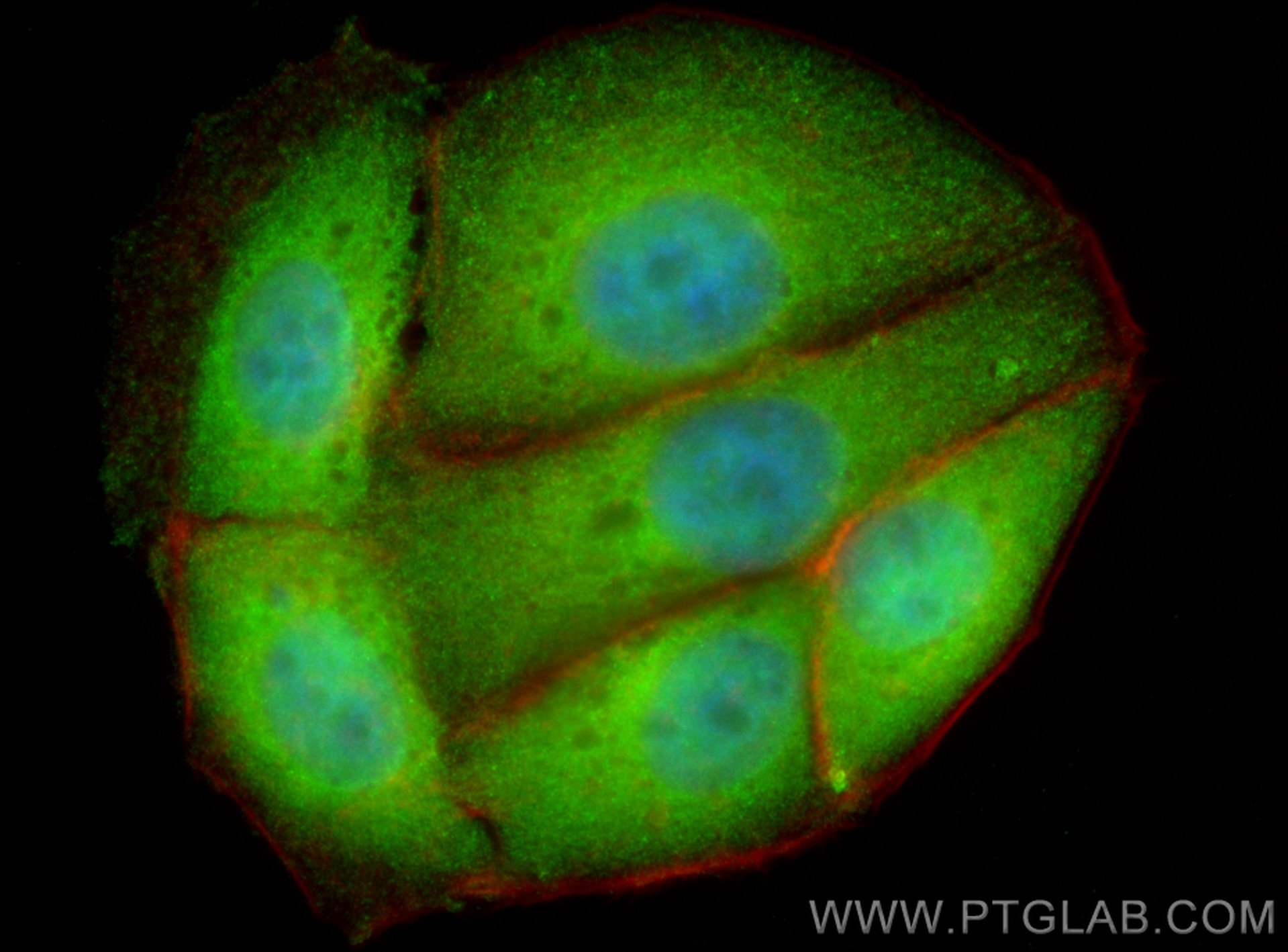 Immunofluorescence (IF) / fluorescent staining of MCF-7 cells using PTK6/BRK Recombinant antibody (85352-2-RR)