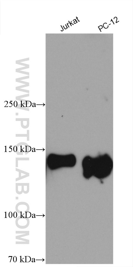 Western Blot (WB) analysis of various lysates using PTK7 Polyclonal antibody (17799-1-AP)