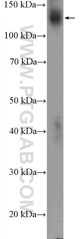 Western Blot (WB) analysis of A431 cells using PTK7 Polyclonal antibody (17799-1-AP)