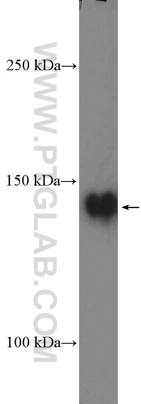 Western Blot (WB) analysis of Jurkat cells using PTK7 Polyclonal antibody (17799-1-AP)