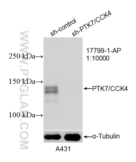 Western Blot (WB) analysis of A431 cells using PTK7/CCK4 Polyclonal antibody (17799-1-AP)