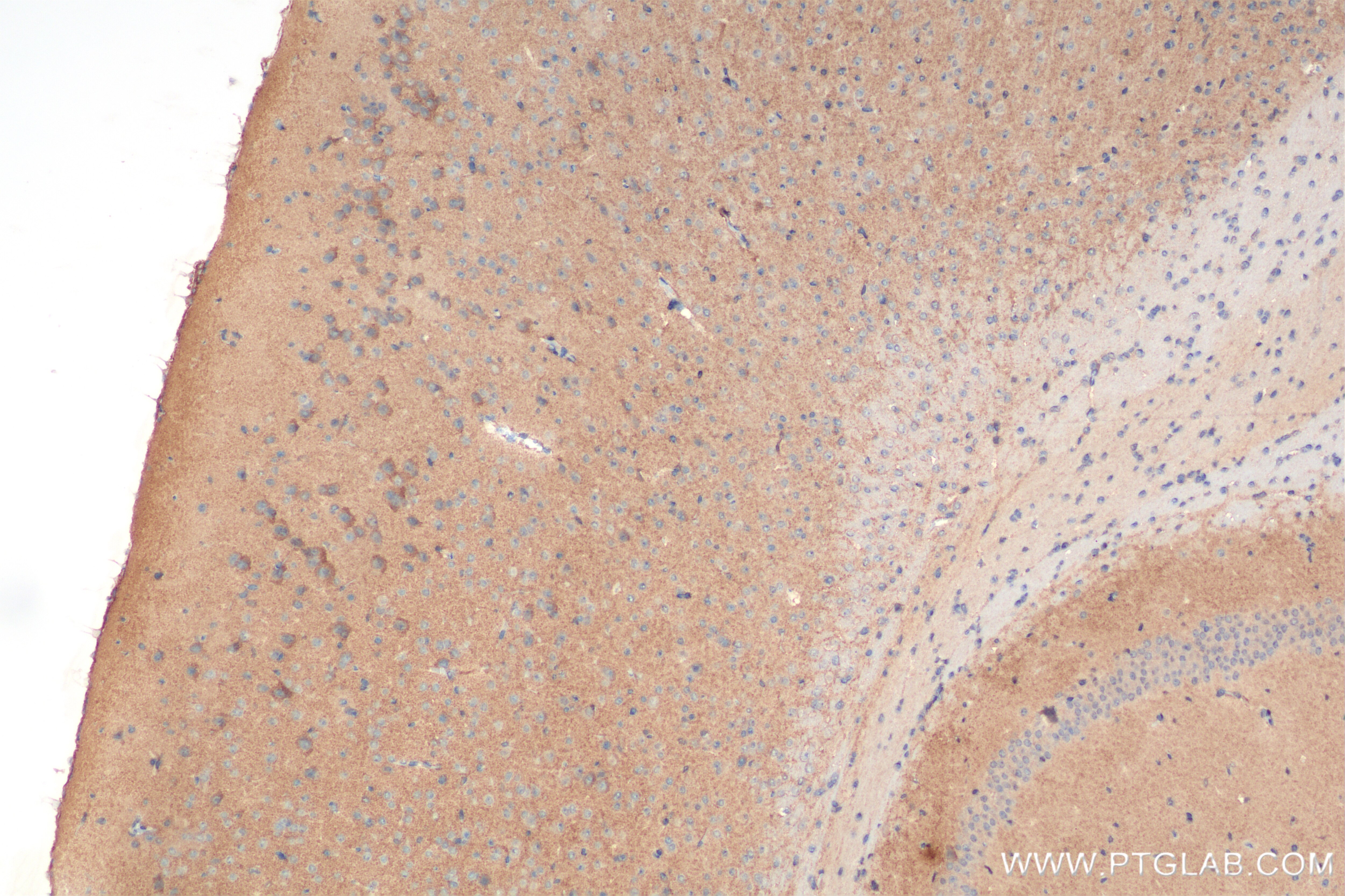 Immunohistochemistry (IHC) staining of mouse brain tissue using PTK7 Recombinant antibody (85075-1-RR)