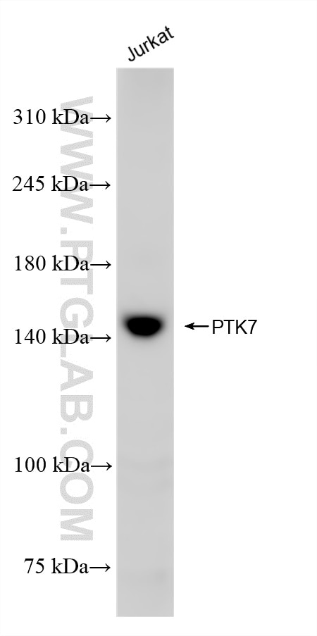 Western Blot (WB) analysis of various lysates using PTK7 Recombinant antibody (85075-1-RR)