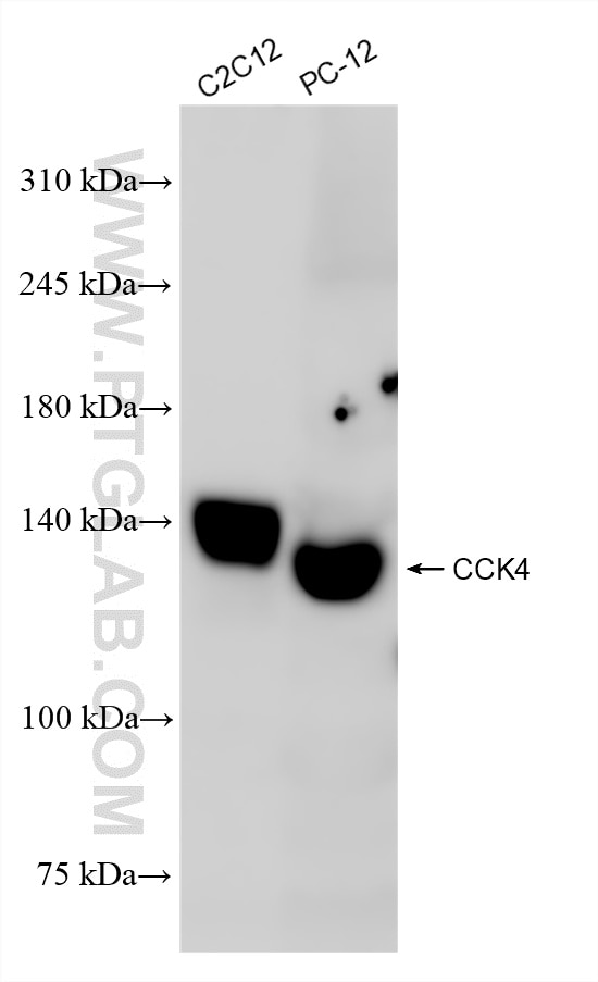 Western Blot (WB) analysis of various lysates using PTK7 Recombinant antibody (85075-1-RR)