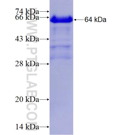 PTK7 fusion protein Ag12004 SDS-PAGE