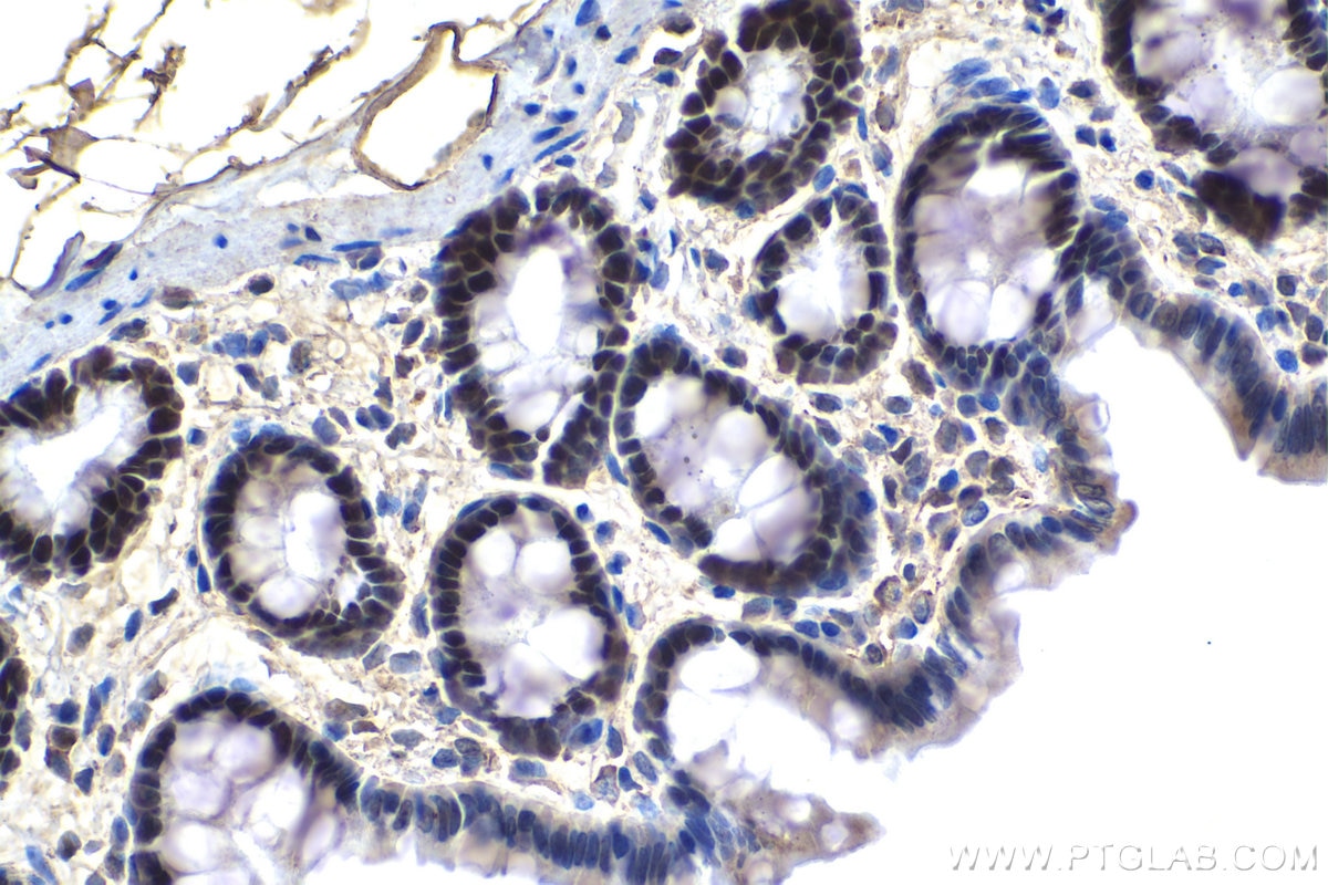 Immunohistochemistry (IHC) staining of rat colon tissue using Prothymosin Alpha Polyclonal antibody (10480-1-AP)