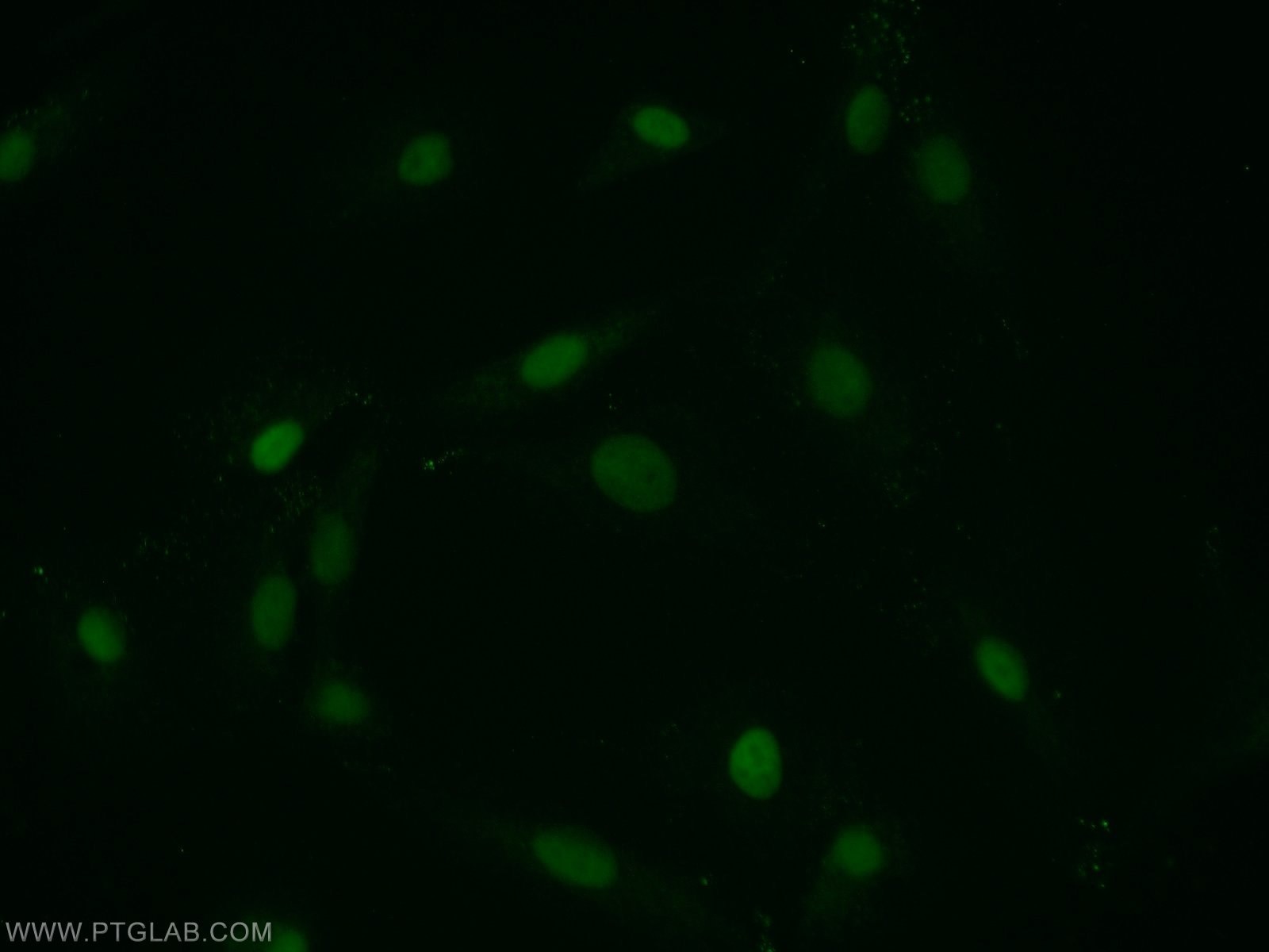 Immunofluorescence (IF) / fluorescent staining of A549 cells using PTMS Polyclonal antibody (12106-1-AP)