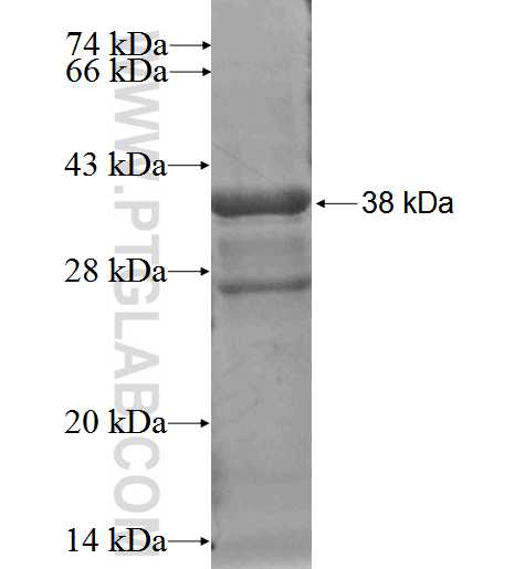 PTMS fusion protein Ag2751 SDS-PAGE