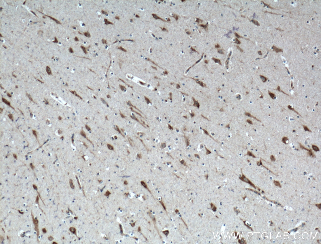 Immunohistochemistry (IHC) staining of human brain tissue using PTN Polyclonal antibody (27117-1-AP)