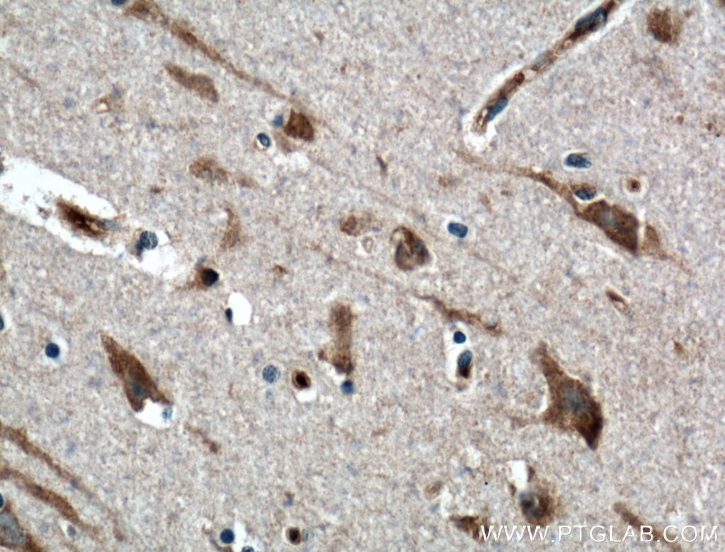 Immunohistochemistry (IHC) staining of human brain tissue using PTN Polyclonal antibody (27117-1-AP)