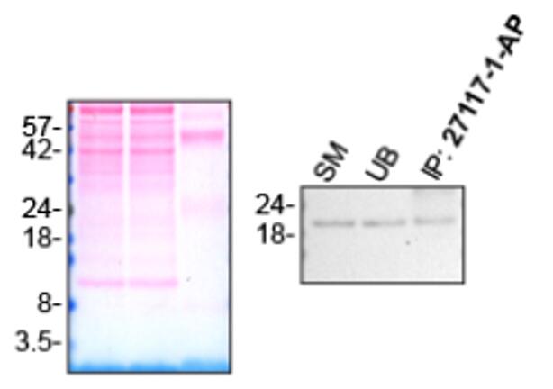 Immunoprecipitation (IP) experiment of U-87 MG cells using PTN Polyclonal antibody (27117-1-AP)