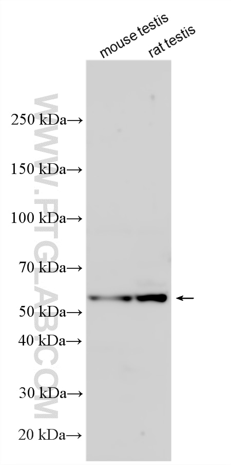 Various lysates were subjected to SDS PAGE followed by western blot with 16575-1-AP (PTOV1 antibody) at dilution of 1:1000 incubated at room temperature for 1.5 hours. Western Blot (WB) analysis of various lysates using PTOV1 Polyclonal antibody (16575-1-AP)