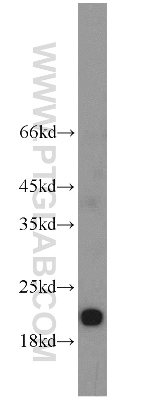 WB analysis of MCF-7 using 11508-1-AP