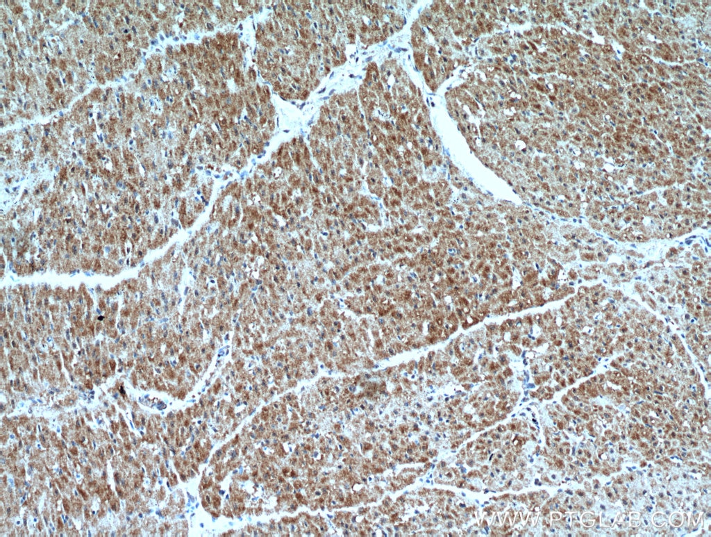 Immunohistochemistry (IHC) staining of human heart tissue using PRL3 Polyclonal antibody (15186-1-AP)