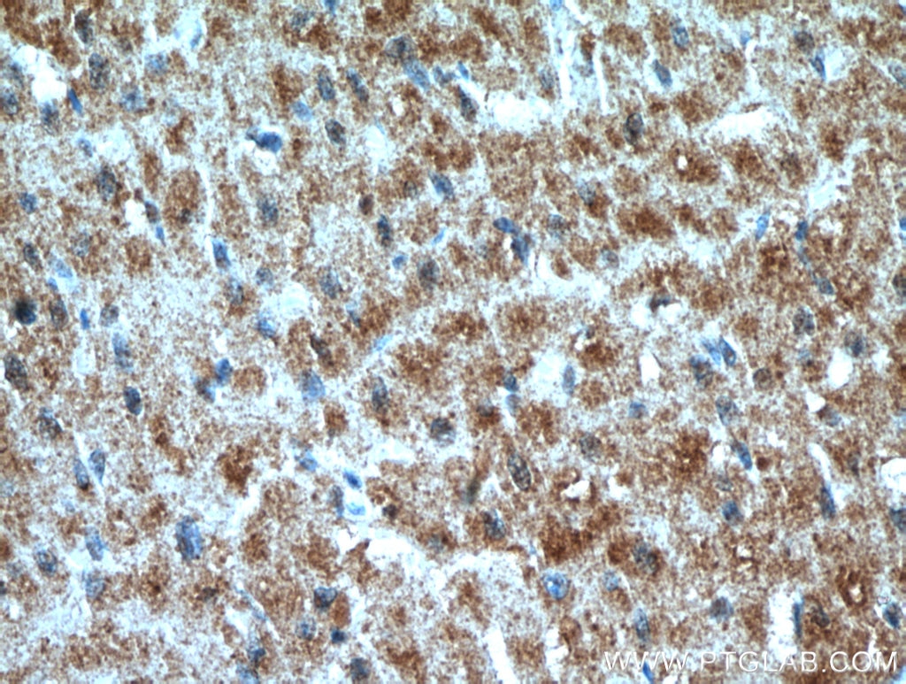 Immunohistochemistry (IHC) staining of human heart tissue using PRL3 Polyclonal antibody (15186-1-AP)