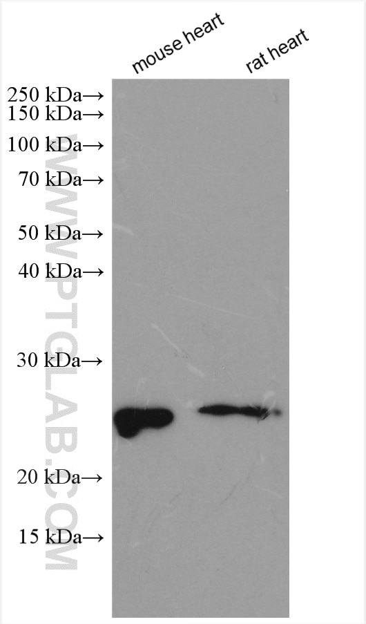 Western Blot (WB) analysis of various lysates using PRL3 Polyclonal antibody (15186-1-AP)