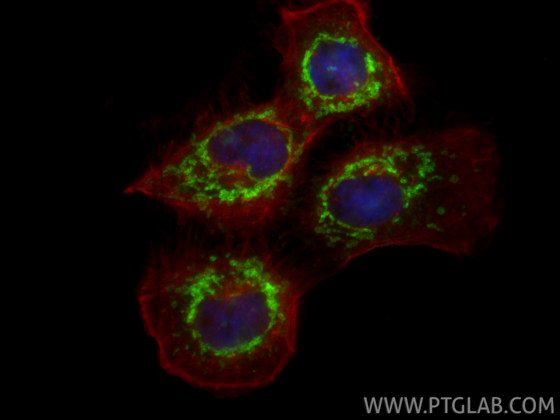 Immunofluorescence (IF) / fluorescent staining of A431 cells using PTPIP51 Polyclonal antibody (20641-1-AP)
