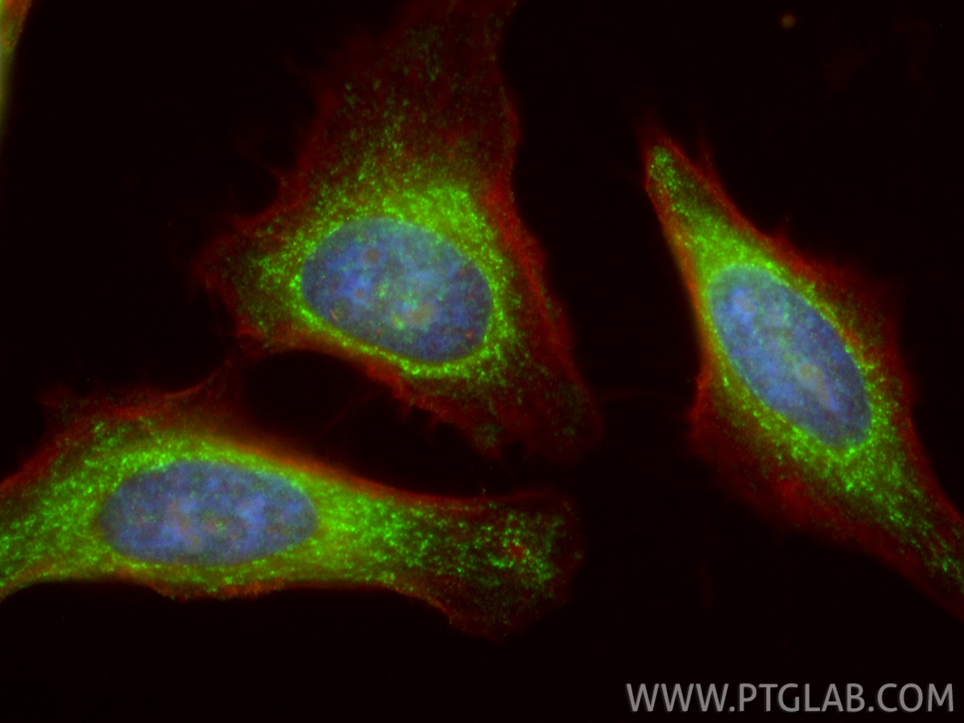 Immunofluorescence (IF) / fluorescent staining of HeLa cells using PTPIP51 Polyclonal antibody (20641-1-AP)