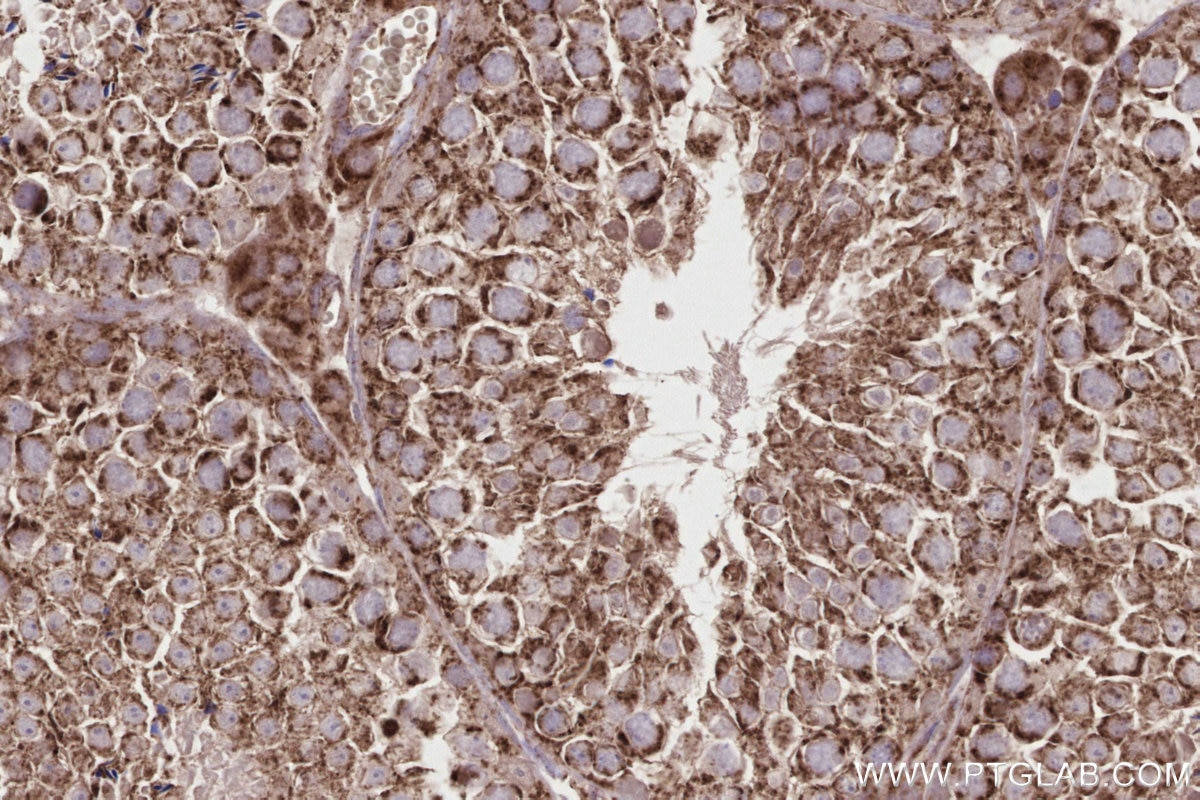 Immunohistochemistry (IHC) staining of mouse testis tissue using PTPIP51 Polyclonal antibody (20641-1-AP)