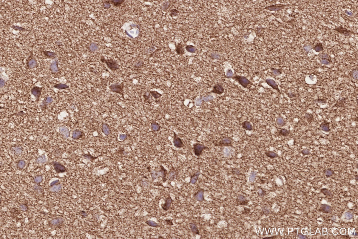 Immunohistochemistry (IHC) staining of mouse brain tissue using PTPIP51 Polyclonal antibody (20641-1-AP)