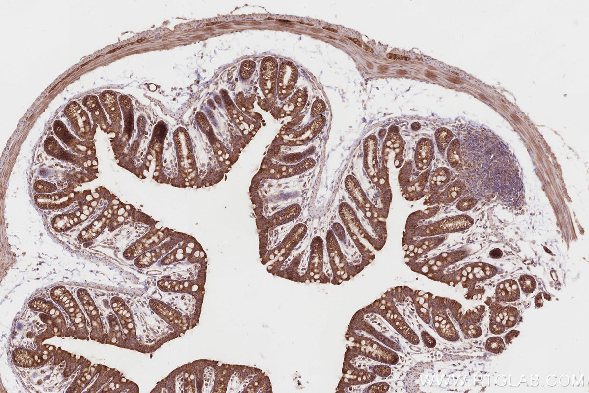 Immunohistochemistry (IHC) staining of mouse colon tissue using PTPIP51 Polyclonal antibody (20641-1-AP)