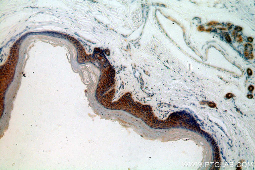 Immunohistochemistry (IHC) staining of human skin tissue using PTPIP51 Polyclonal antibody (20641-1-AP)