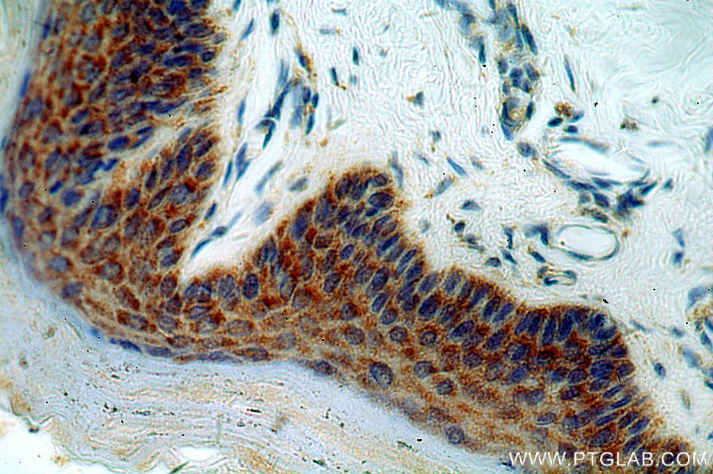 Immunohistochemistry (IHC) staining of human skin tissue using PTPIP51 Polyclonal antibody (20641-1-AP)