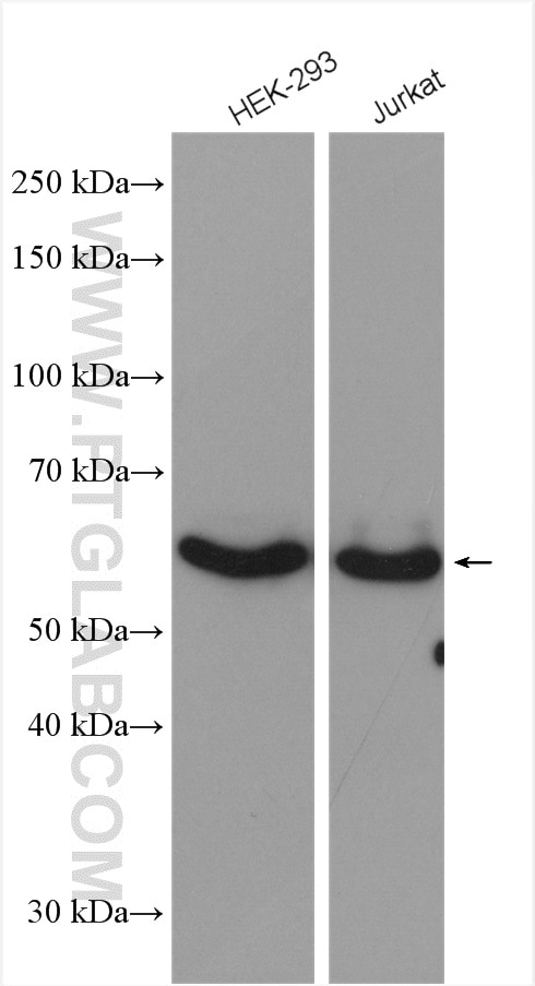 Western Blot (WB) analysis of various lysates using PTPIP51 Polyclonal antibody (20641-1-AP)