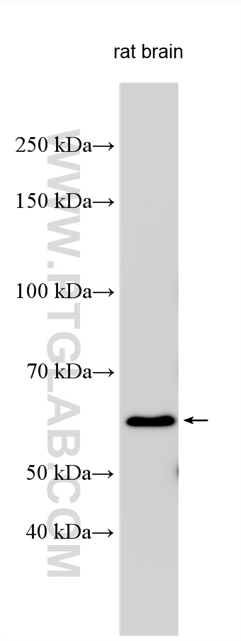 Western Blot (WB) analysis of various lysates using PTPIP51 Polyclonal antibody (20641-1-AP)