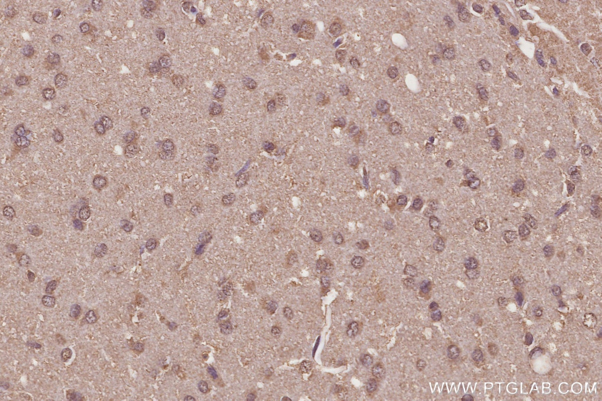 IHC staining of rat brain using 68582-1-Ig Immunohistochemistry (IHC) staining of rat brain tissue using PTPIP51 Monoclonal antibody (68582-1-Ig)
