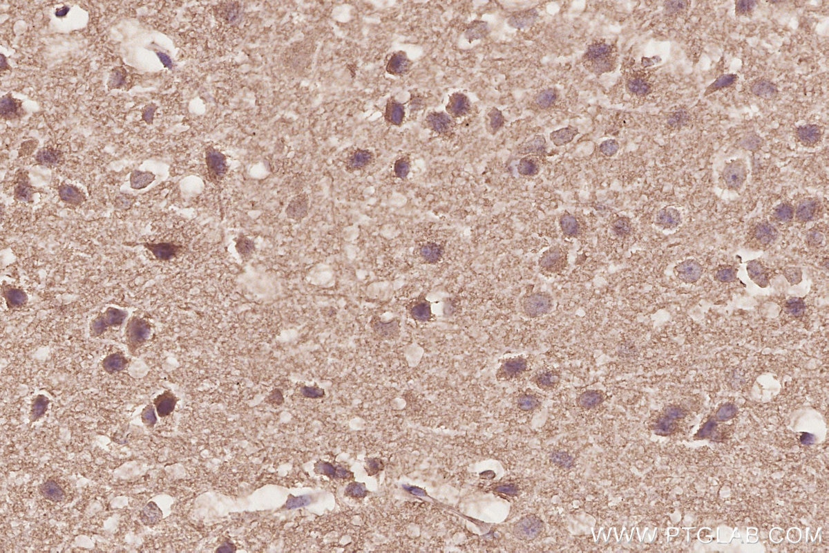 IHC staining of mouse brain using 68582-1-Ig Immunohistochemistry (IHC) staining of mouse brain tissue using PTPIP51 Monoclonal antibody (68582-1-Ig)