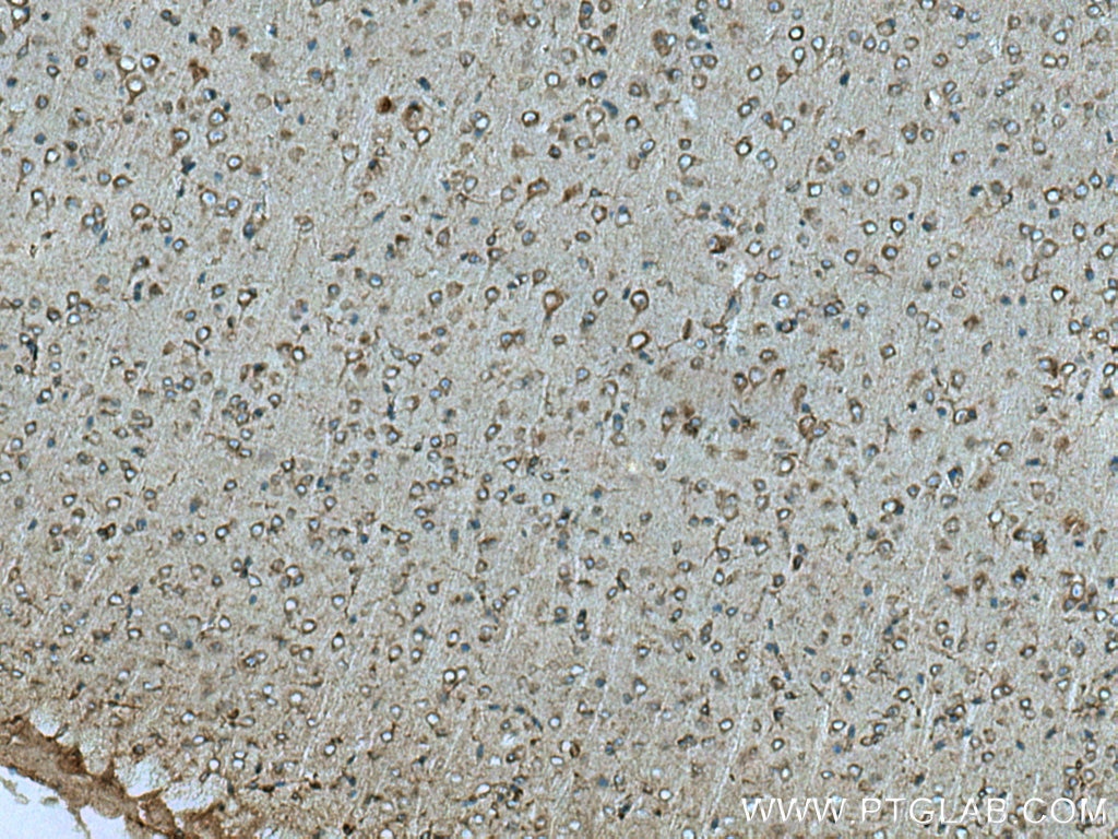 ptplad1-antibody-28572-1-ap-proteintech