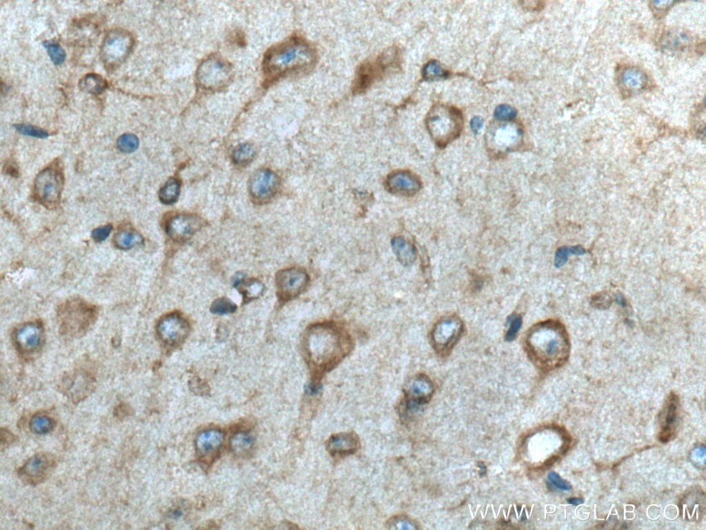 ptplad1-antibody-28572-1-ap-proteintech