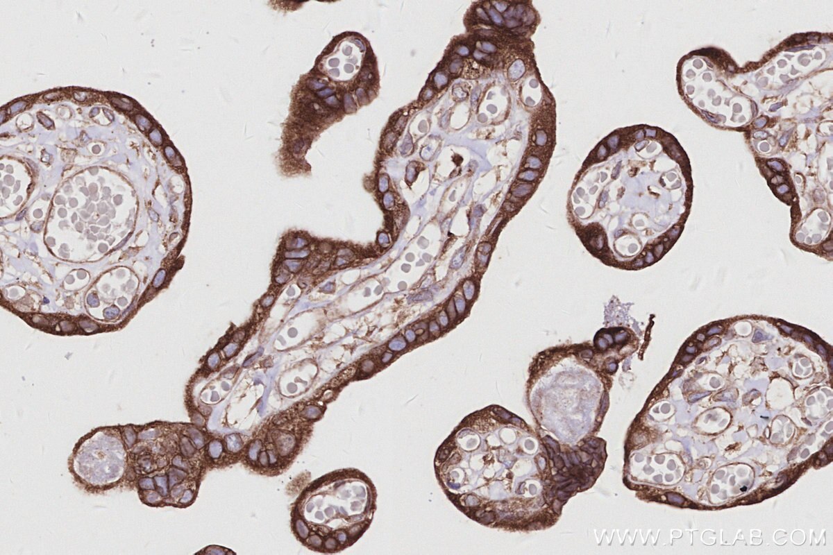 Immunohistochemistry (IHC) staining of human placenta tissue using PTPLAD1 Polyclonal antibody (28572-1-AP)
