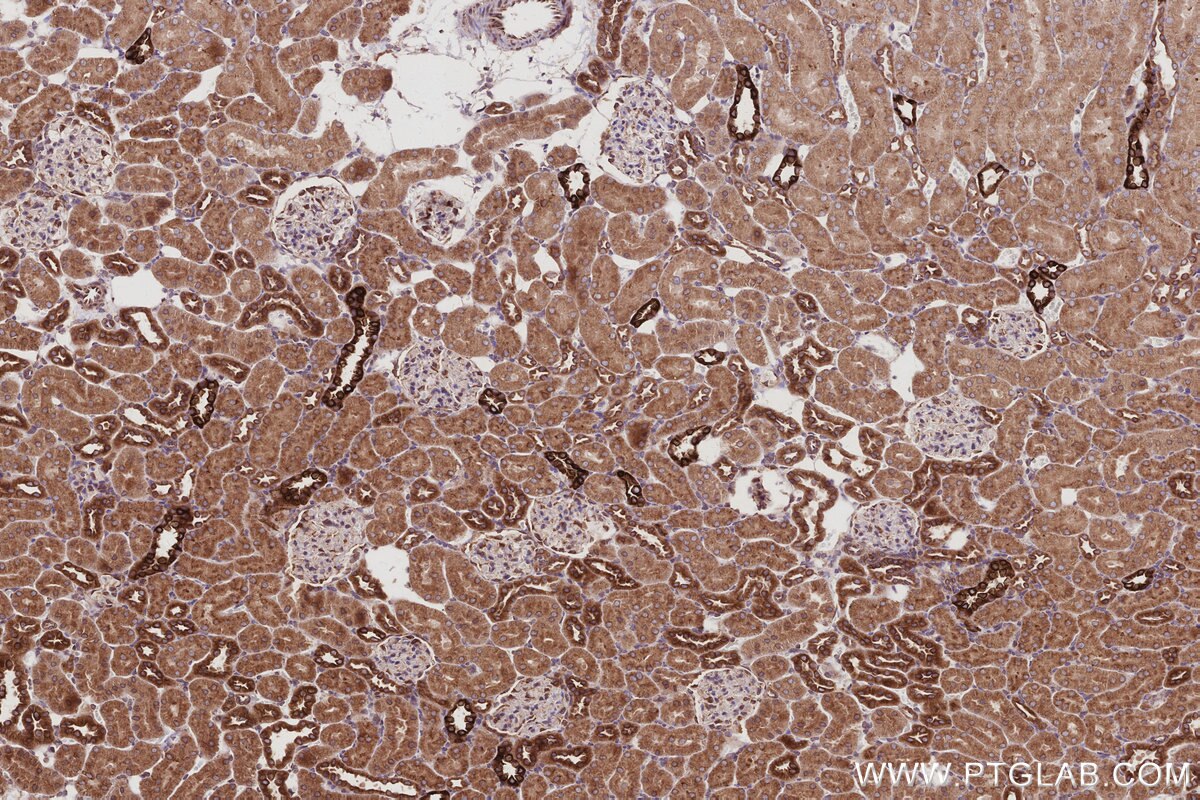 Immunohistochemistry (IHC) staining of rat kidney tissue using PTPLAD1 Polyclonal antibody (28572-1-AP)