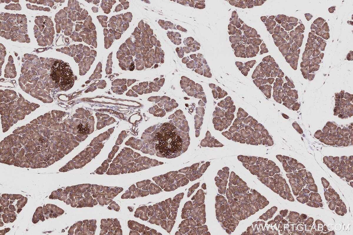 Immunohistochemistry (IHC) staining of rat pancreas tissue using PTPLAD1 Polyclonal antibody (28572-1-AP)