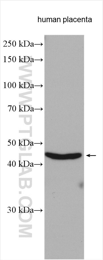 Western Blot (WB) analysis of various lysates using PTPLAD1 Polyclonal antibody (28572-1-AP)