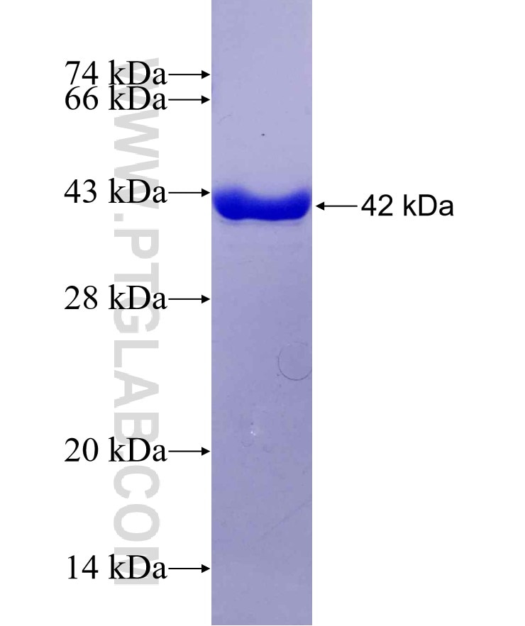 PTPLAD1 fusion protein Ag29557 SDS-PAGE