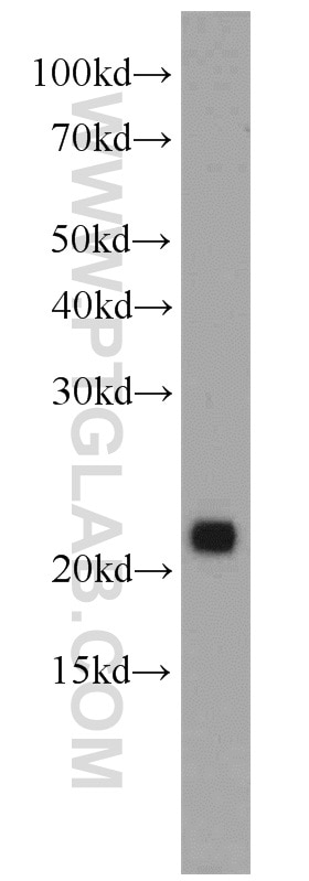 Western Blot (WB) analysis of mouse pancreas tissue using PTPMT1 Polyclonal antibody (11493-1-AP)