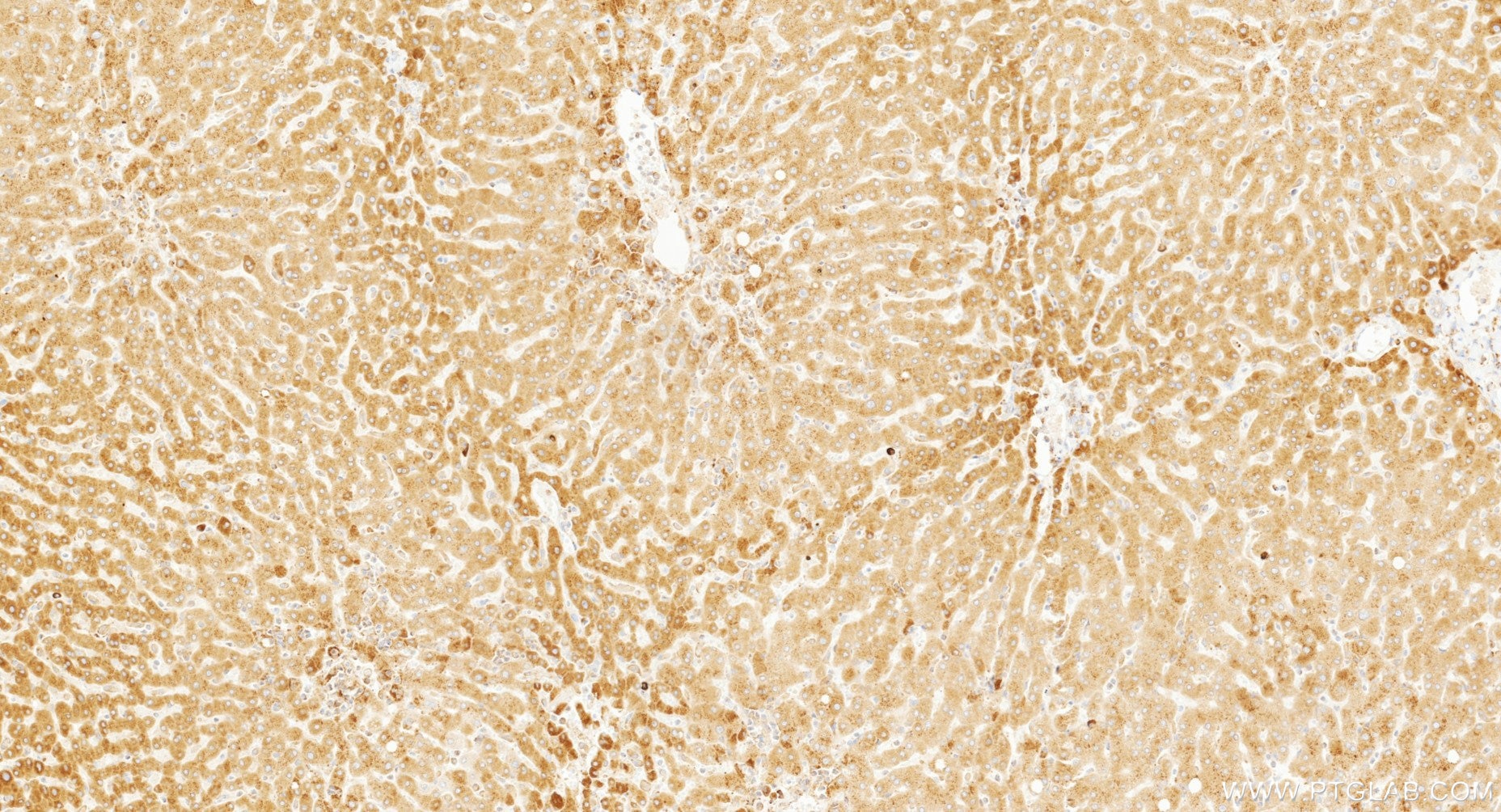 Immunohistochemistry (IHC) staining of human liver tissue using PTPMT1 Recombinant monoclonal antibody (87082-1-RR)