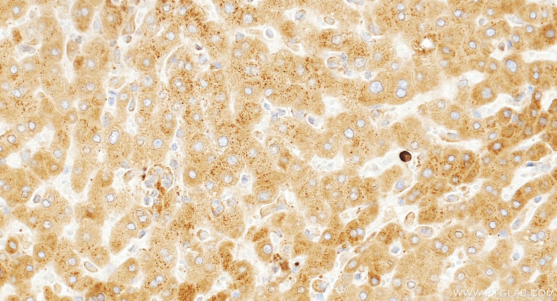 Immunohistochemistry (IHC) staining of human liver tissue using PTPMT1 Recombinant monoclonal antibody (87082-1-RR)